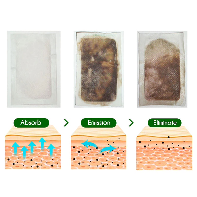 GFOUK™ Echtes Detox Lymphdrainage-Fußpads