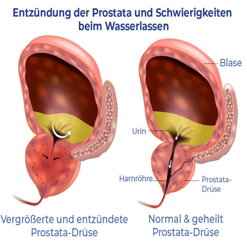 GFOUK™ PRO Natürliche pflanzliche Stärke Hämorrhoiden-Kapseln