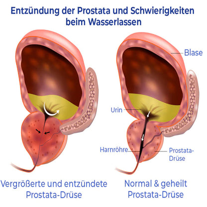 GFOUK™ PRO Natürliche pflanzliche Stärke Hämorrhoiden-Kapseln