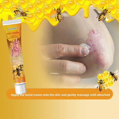 GFOUK™ Bienengift Psoriasis Lindernde Creme