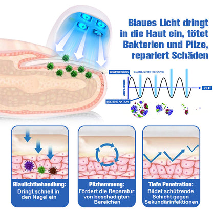 Furzero™ Nagelpilzreinigung Laser Linderungsgerät