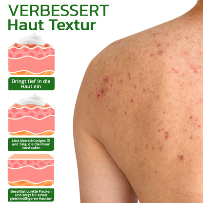 GFOUK™ BodyTreat Kollagen-Peeling-Essenz