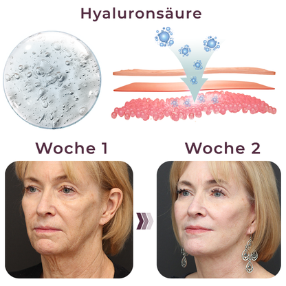 GFOUK™ Schnell VFacelift Natürlich aussehendes Klebeband