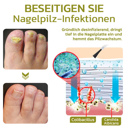 GFOUK™️ Intensives Serum für Nagelwachstum und stärkung