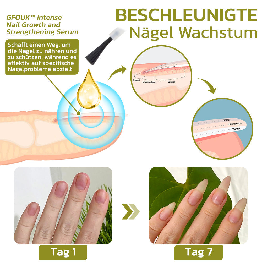 GFOUK™️ Intensives Serum für Nagelwachstum und stärkung