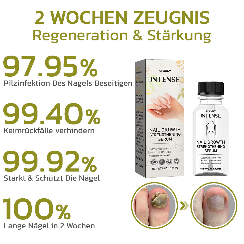 GFOUK™️ Intensives Serum für Nagelwachstum und stärkung