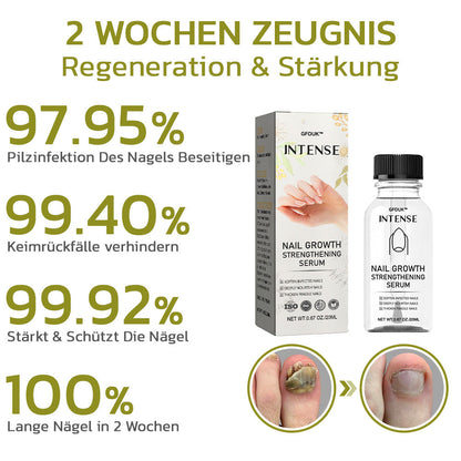 GFOUK™️ Intensives Serum für Nagelwachstum und stärkung