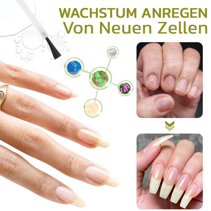 GFOUK™️ Intensives Serum für Nagelwachstum und stärkung