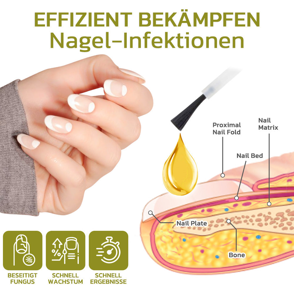 GFOUK™️ Intensives Serum für Nagelwachstum und stärkung