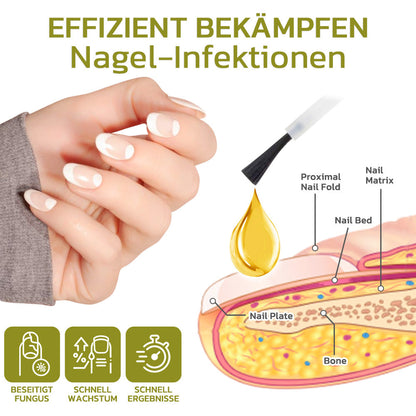 GFOUK™️ Intensives Serum für Nagelwachstum und stärkung