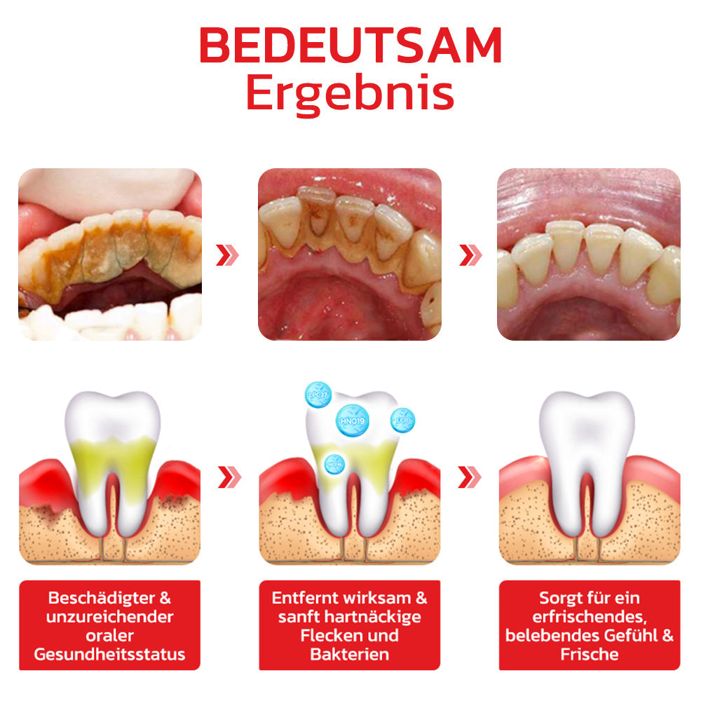 GFOUK™️ SP4 Probiotische aufhellende Zahnpasta