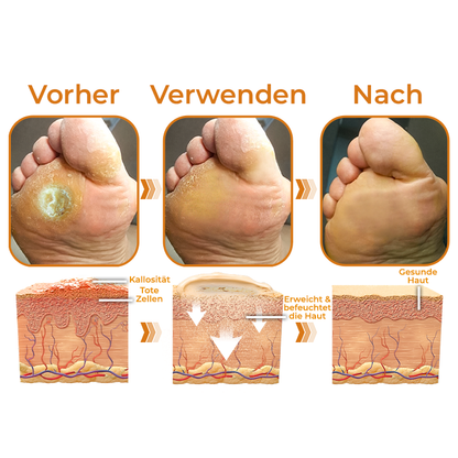 GFOUK™ Pferdeöl Hornhaut Abhilfe Balsam