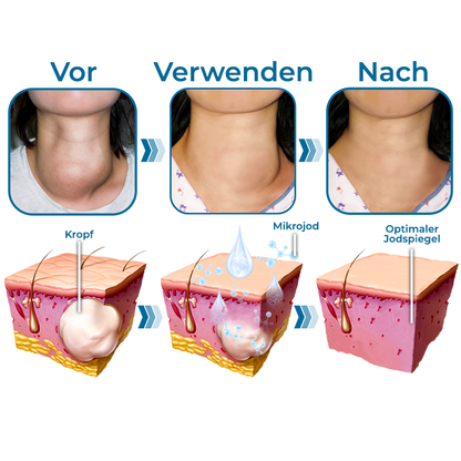 GFOUK™ Nackenkropf-und Straffungstherapie-Serum