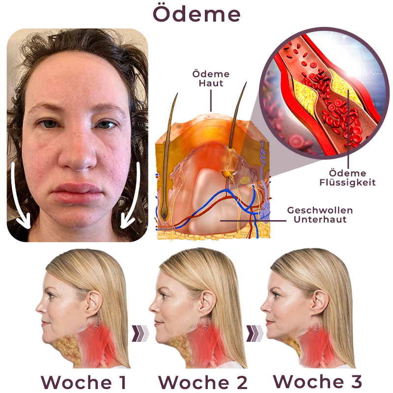 GFOUK™ Schnell VFacelift Natürlich aussehendes Klebeband