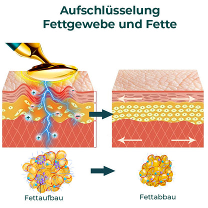 GFOUK™ VorSculpt V-Gesichtskonturierungsgerät