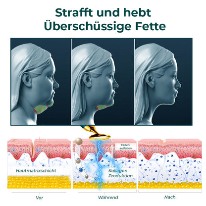 GFOUK™ VorSculpt V-Gesichtskonturierungsgerät