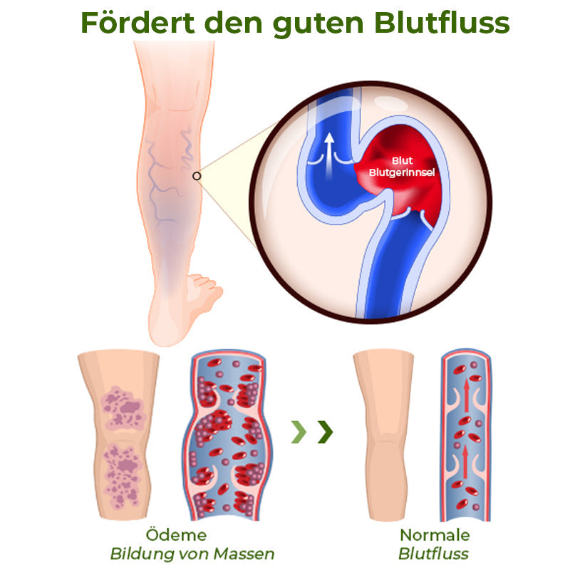 GFOUK™ Fußödem Therapiepflaster