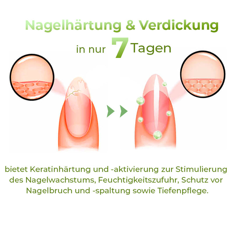 GFOUK™ PureCare Nagelbelebungsstifte