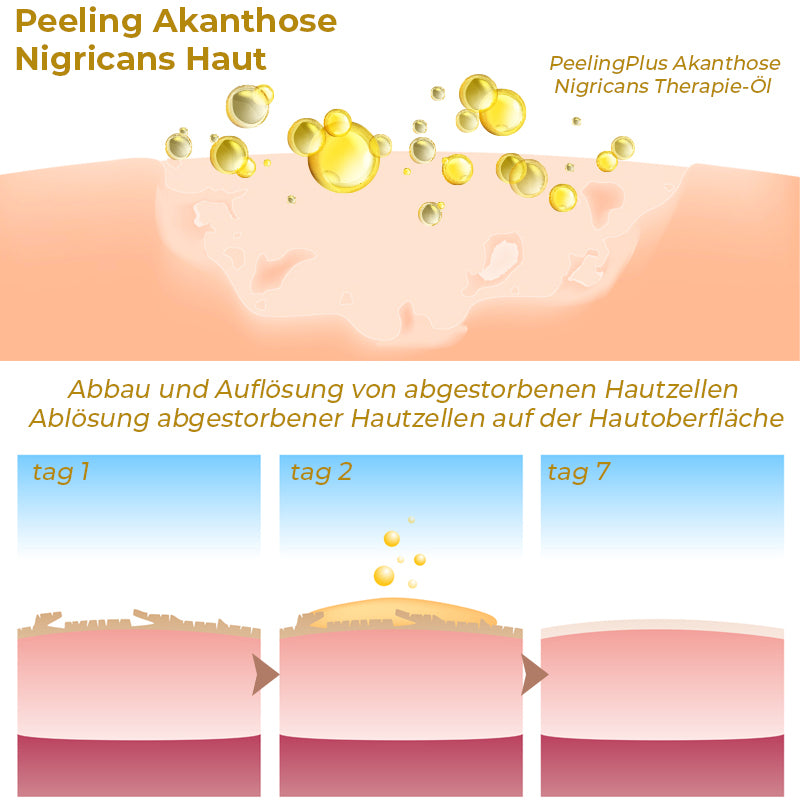 GFOUK™ PeelingPlus Acanthosis Nigricans Therapie-Öl