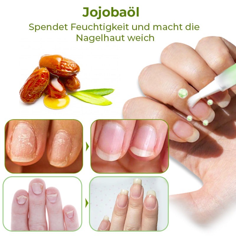 GFOUK™ PureCare Nagelbelebungsstifte