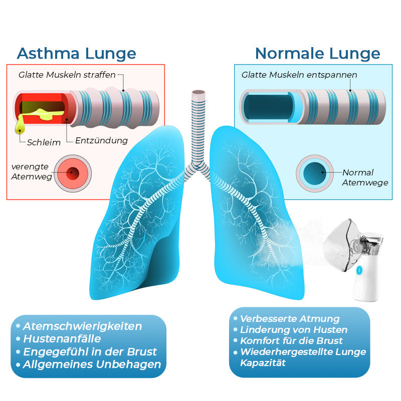 GFOUK™ LungDetox Vernebler-Reinigungsspray