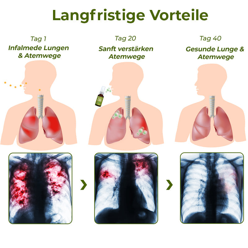 GFOUK™️ BreathDetox Kräuter-Lungenreinigungsspray