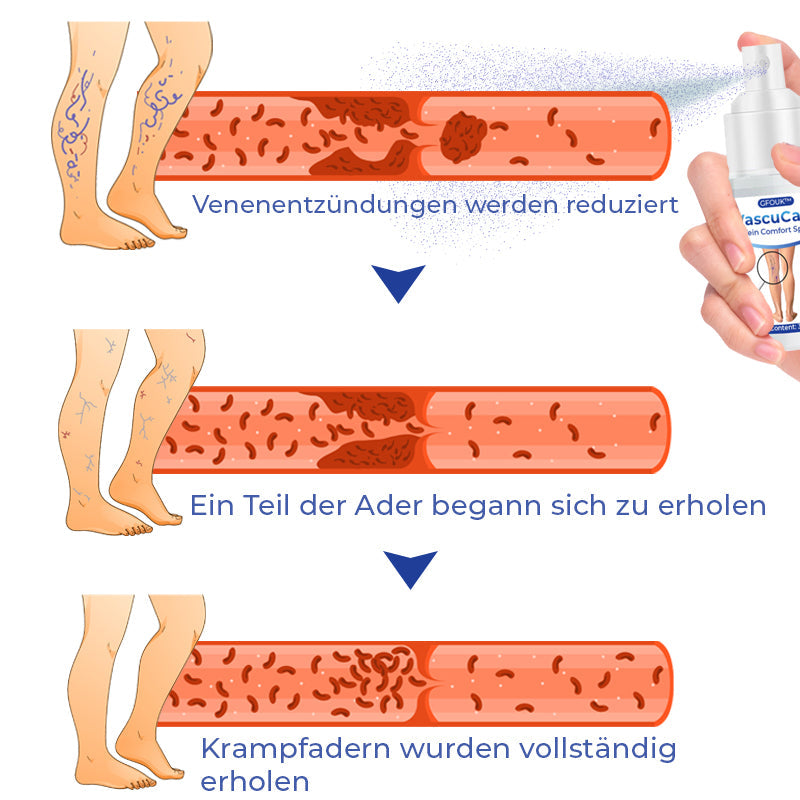 GFOUK™ VascuCare Venen-Komfort-Spray